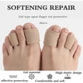 thumbnail image 2 of NOGIS Toe Sleeve Protector Tubes - Cushion Fabric with Gel Lining (5 Pack) Finger Toe Separator Tubing for Bunion, Hammer Toe, Callus Corn, Blister, 2 of 7