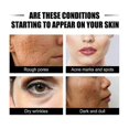thumbnail image 4 of Jaysuing Ginseng Snail Essence Fading Wrinkle Brightening Skin Color Moisturizing Repair Skin Dull Anti-Wrinkle Essence - 30Ml, 4 of 5