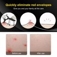 thumbnail image 3 of Electronic Itch Relief Pen, Itch Relief Stick ABS Vibration Massage  for Travel for Outdoor Activity, 3 of 8