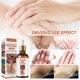 thumbnail image 5 of 2-Pack Knuckle Whitening Serum Skin Glow Fading Acne Dark Spot Correcting Facial Whitening Serum, 5 of 5