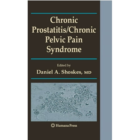 chocolate y prostatitis