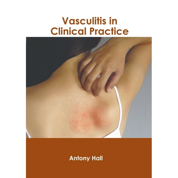 Vasculitis in Clinical Practice, (Hardcover)
