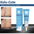 thumbnail image 4 of Women's Beauty And Scar Removal Keeps The Face Moisturized And Repairs Damaged Skin Scar Gel 15g, 4 of 4