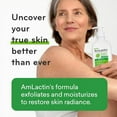 Amlactin Daily Moisturizing Body Lotion For Keratosis Pilaris AmLactin Daily Moisturizing Lotion for Dry Skin – 7.9 oz Pump Bottle