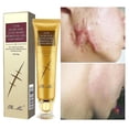 thumbnail image 1 of Crema para eliminar cicatrices de acné, cuidado de la piel, tratamiento de estrías, espinillas, reparación de manchas, Gel, blanqueamiento, humectante, Cosméticos de belleza suaves Feliz Sencillez, 1 of 1