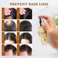 thumbnail image 2 of Sérum para el crecimiento del cabello Venanoci, biotina, aceite de ricino y romero para mujeres, 2 of 7