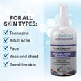 thumbnail image 3 of Limpiador facial SkinSmart Antimicrobiano para el acné en aerosol de 240 ml, 3 of 9