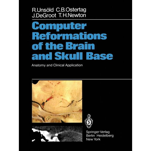 Computer Reformations of the Brain and Skull Base: Anatomy and Clinical Application, (Paperback)