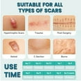 thumbnail image 5 of Gowinsee Silicone Scar Sheets 2 Rolls, Burn Scars C-Section, Medical Grade Silicone Scar Tape Scar Removal Strips for Acne, 5 of 5