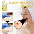thumbnail image 5 of Bee Venom Anti-Wart Spray, Bee Venom Spray,2025 New Tag Recede Bee Venom Treatment Spray for Women and Men, 5 of 5
