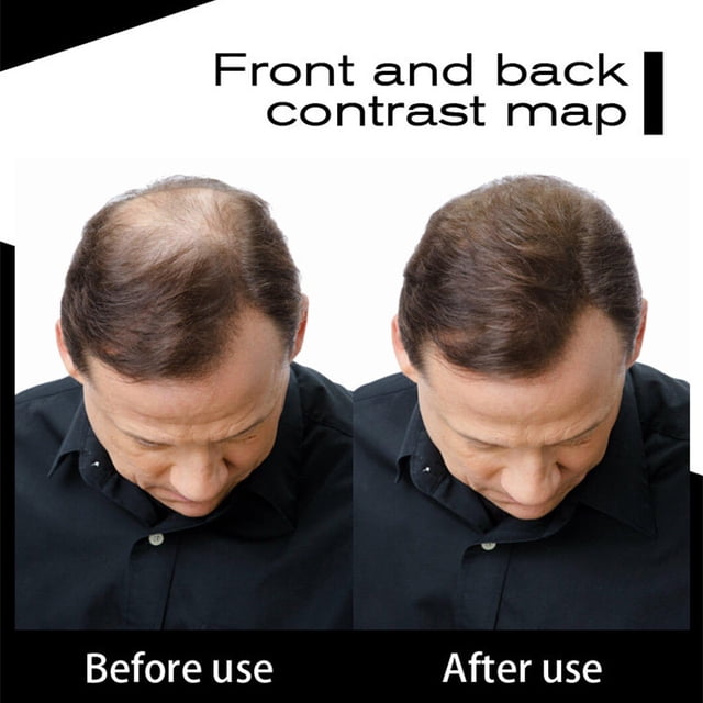 Bolsa de fibra vegetal para el cabello 100 g para la caída del cabello calvo, cabello denso y rápido, para peinar pelucas