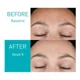 thumbnail image 5 of Cerave Retinol Serum Para Las Marcas De Post-acné CAIXIN Sérum, 5 of 7
