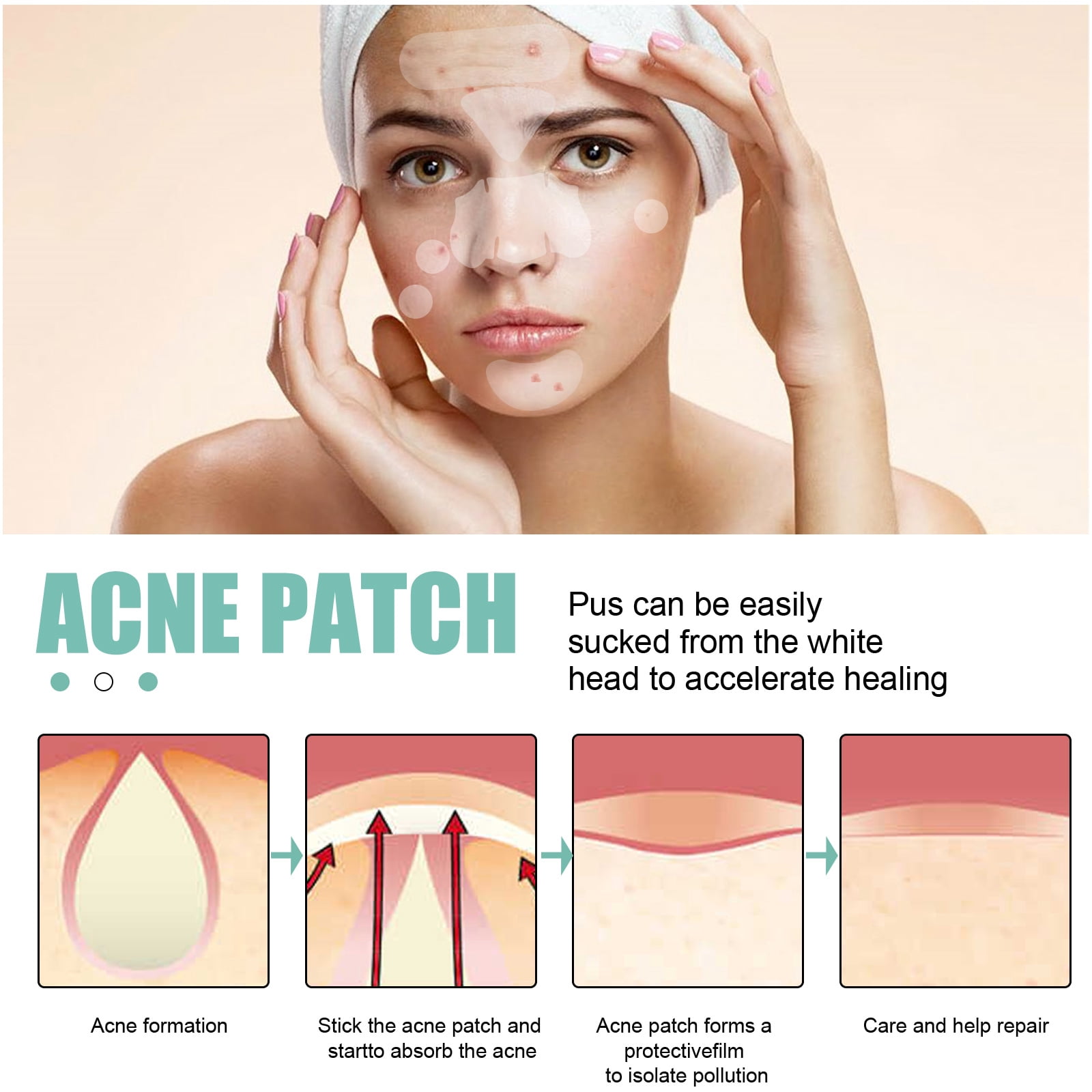 Alvantor Acne Patches Hydrocolloid Pimple Patches for Face, Zit Cover Invisible Spot Stickers, 132Patches