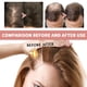 thumbnail image 3 of Suero Para El Cabello, 2 Ml, Fortalecedor, 21 Piezas, Juego De Ampollas Para El Crecimiento Del Cabello, Antipérdida, Sin Irritación Para Hombres, 3 of 7