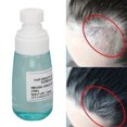 thumbnail image 4 of Spray Para El Crecimiento Del Cabello, Inhibición De Bacterias Reparación Del Cuero Cabelludo Minoxidil Spray Para El Crecimiento Del Cabello 70ml Spray Absorción De Nutrientes ANGGREK Hair Growth Spray, 4 of 8