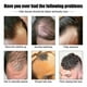 thumbnail image 3 of East Moon Men's Hair Essence Nutritious Moisturizing Hair Care Solution 30ml, 3 of 5