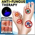 thumbnail image 4 of 2pcs Anti-fungal Home Treatment Set Toenail Treatment Pen, Onychomycosis Repair Laser And Pen,quick And Visible, Safe And Easy To Use-xgm-xgm, 4 of 5