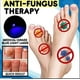 thumbnail image 4 of 2pcs Anti-fungal Home Treatment Set Toenail Treatment Pen, Onychomycosis Repair Laser And Pen,quick And Visible, Safe And Easy To Use-xgm-xgm, 4 of 5