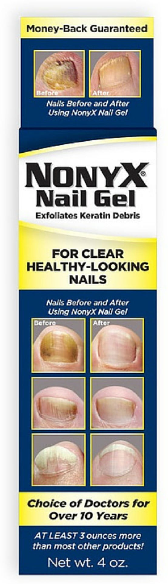 3-pack-nonyx-nail-gel-4-oz-walmart-walmart