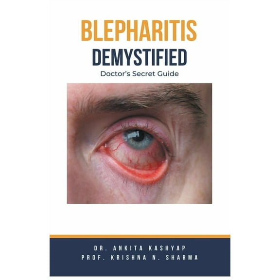 Blepharitis Demystified: Doctor's Secret Guide, (Paperback)