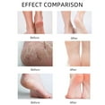 thumbnail image 4 of Exfoliating Foot Spray, Moisturizing Foot Care, Hydrating Foot Treatment for Soft Feet, Clean and Smooth Skin, Ideal for Daily Use, Compact 20ml Size, 4 of 8