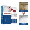 thumbnail image 1 of Anti-mould Spray, Mould Cleaner Anti-mould Cleaning Foam, Powerful Multi-purpose Foam Cleaner, Removes Stains, 1 of 5