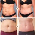 thumbnail image 3 of Anti Cellulite Firming Soap, Natural Organic Weight Loss Soap, Anti-Cellulite Full Body Slimming, for All Skin Types, 3 of 5