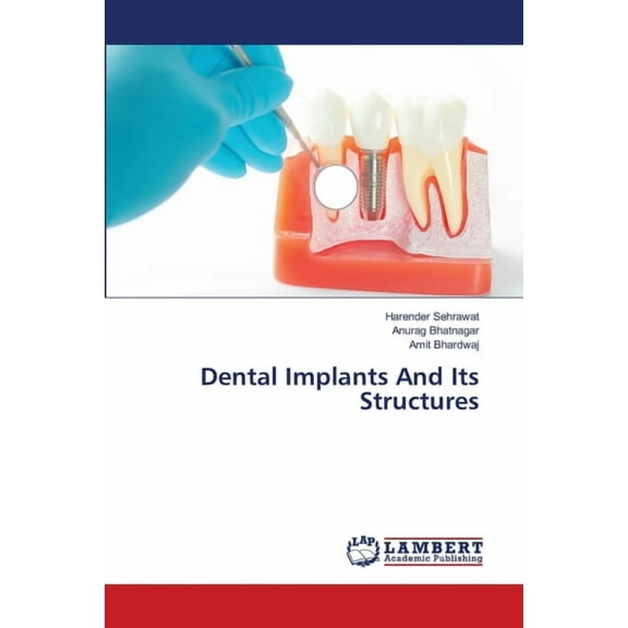 Dental Implants And Its Structures (Paperback)