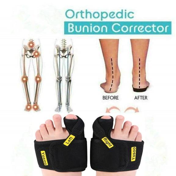 Yosoo 1 Pair Adjustable Soft Bunion Splints Brace Big Toe Straighteners Separators, Bunion Correctors for Overlapping Toe, Hallux Valgus, Calluses, Bunion Pads for Women/Men