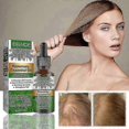thumbnail image 4 of Rosemary Hair Growth Oil Fast Growing Anti Hair Loss, 4 of 5