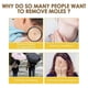 thumbnail image 4 of Skin Tag Recede Bee Venom Treatment Cream, Tag Remover, Bee Venom Cream, for All Skin Types, 4 of 5