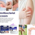 thumbnail image 2 of Crema para la picazón de la piel, 1/2 Uds., 30g, para manos, piernas, picazón y crema tópica, 2 of 5