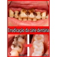 thumbnail image 5 of Reparación de caries dentales, eliminación de manchas de placa, blanqueamiento dental, 5 of 5