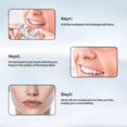 thumbnail image 5 of Enderezador de dientes Yuxing juego de ortodoncia para adultos 3 piezas, 5 of 5