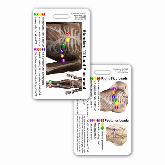 12 Lead EKG Placement Vertical Badge Reference Card (Pack of 5)