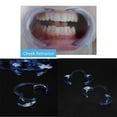 thumbnail image 3 of Abridor de boca de dentista dental tipo C reutilizable Retractor de labios y mejillas (L) Likrtyny  cuidado belleza, 3 of 7
