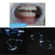 thumbnail image 2 of Abridor de boca de dentista dental tipo C reutilizable Retractor de labios y mejillas (M) Likrtyny  cuidado belleza, 2 of 6