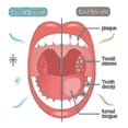thumbnail image 4 of 3 Bottles 100ml Teethaid Calculus Removal Teeth Mouth Eliminating Bad Preventing And Caries Tooth Re 100ML 1Pcs, 4 of 5