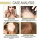 thumbnail image 4 of 3Pcs Natural Hair Growth Oil, Veganic Organic Natural Hair Growth Oil 60ml, 4 of 5