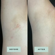 Miami Beach Bum, Bum + Body Cream Clears Acne, Ingrown Hairs, Razor Bumps and Dark Spots, 6.7oz, Orange
