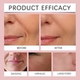 thumbnail image 3 of Bio-Collagen Real Deep Mask,Bio Collagen Face Mask,Bio Collagen Face Mask，Collagen Films Korean Deep Hydrating Firming Hydrogel Mask,Korean Skin Care,1PCS, 3 of 7