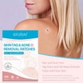 thumbnail image 3 of Ingredients And Effective Remover Tag 108PCS Removal Tag And Skin Improved Patch-Skin Removal Patches, Quick and Effective Removal Sticker for All Kinds of Skin, Friendly to New-User,Patch,1pack, 3 of 8