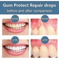 thumbnail image 4 of 1-3Pcs 30ML Quickly Gum Repair Serum Drops Relief Periodontal Protect Gum Repair Drops Whitening Teeth Toothpaste, 4 of 5