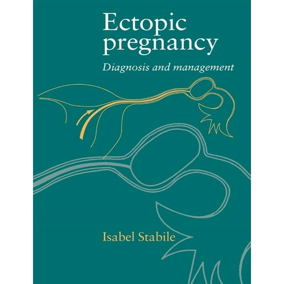 Ectopic Pregnancy: Diagnosis and Management, (Paperback)