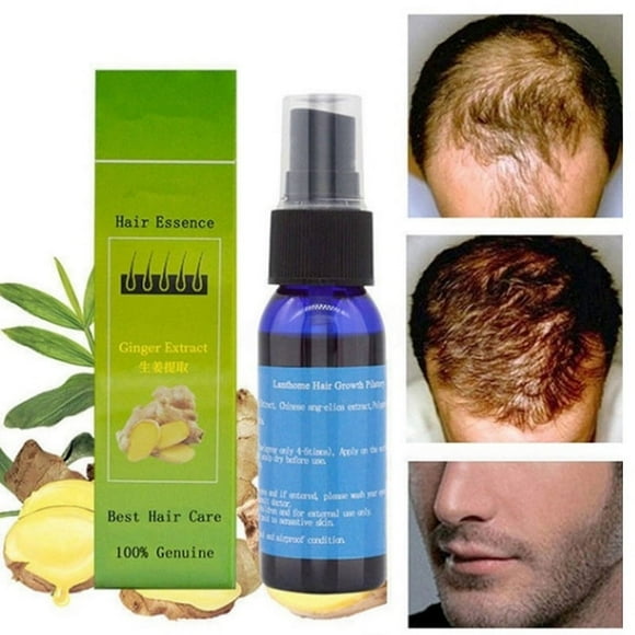 Suero para el crecimiento del cabello de 30ml, extracto Natural, suero para el crecimiento del cabello antipérdida, cuidado del cabello