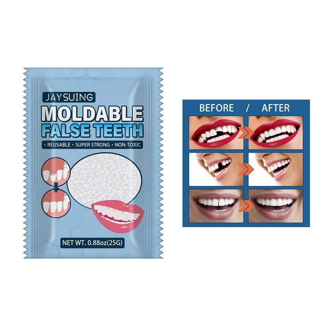 de reparación de temporales de 20G, herramienta de reparación de temporales, dentadura postiza moldeable, de relleno de Colco perlas de reparación de dientes