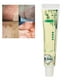 thumbnail image 4 of Crema Para La Picazón En La Piel 15g Extracto De Hierbas Chinas Picazón De La Piel Tratamiento De Alergias Salud Crema Para El Cuidado De La Piel YLSHRF Skin Allergy Cream, 4 of 8