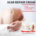 thumbnail image 5 of Crema reparadora de cicatrices cicatrices de acné eliminar cuidado de la piel de mujeres embarazadas, 5 of 5