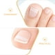 thumbnail image 3 of 5 tiras correctoras transpirables para el tratamiento de uñas encarnadas, cuidado de las uñas, tira para el dedo gordo, enderezador de uñas transparente para la corrección de uñas de los pies, 3 of 8
