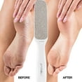 thumbnail image 3 of Probelle Nickel Foot File - White, 3 of 5